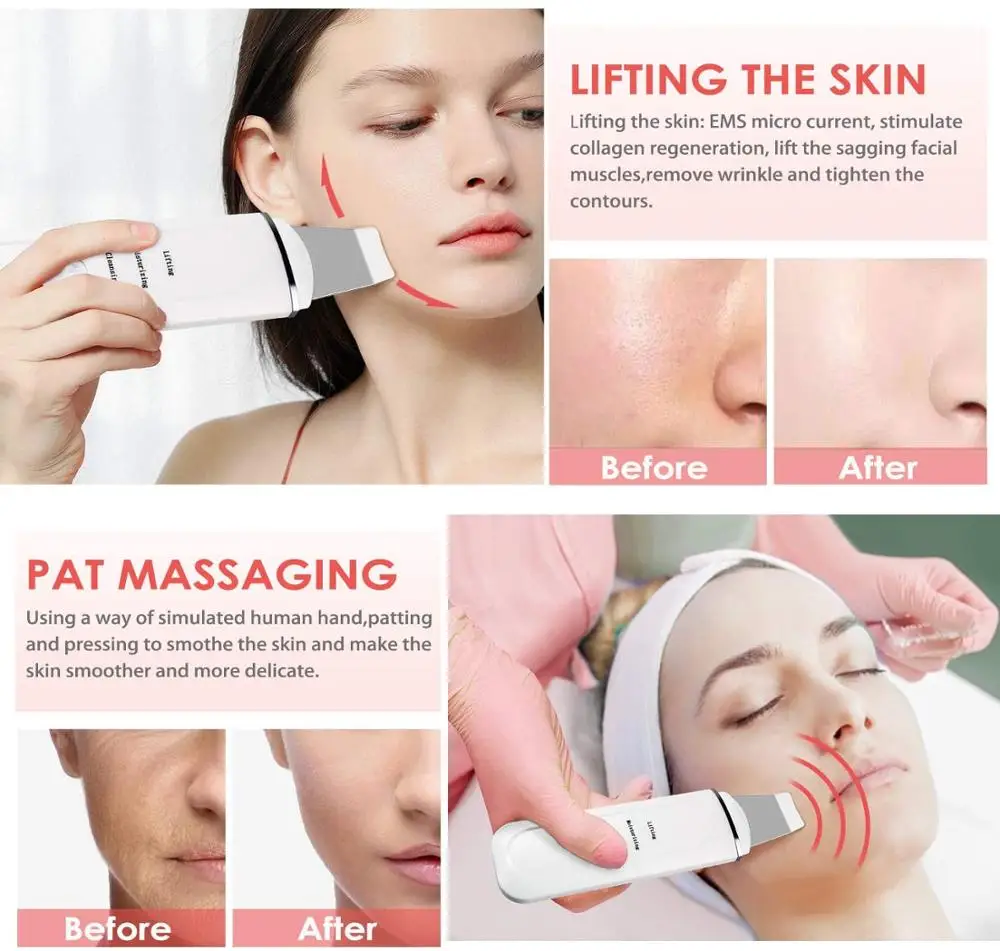 45&deg;C Heat Facial Skin Scrubber Electric Ultrasonic EMS Ion Face Cleaner Blackhead Removal Face Lifting Massager Wrinkle Remover
