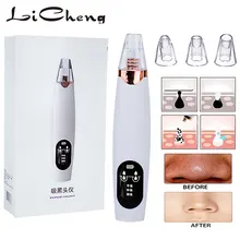 Средство для удаления черных точек Licheng очиститель для лица глубокая пора черная головка Удаление прыщей вакуумное всасывание уход за кожей лица