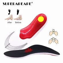 Удобная ортопедическая стелька-супинатор Cubitus Varus ортопедические стельки для обуви вставка для поддержки свода коврик для подошвенного фасциита