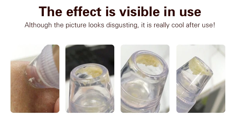 英文吸黑头美容仪_11