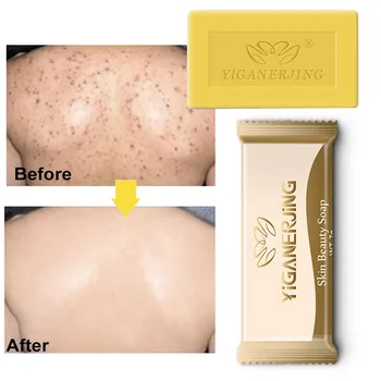 

Sulfur Soap Oil Control Acne Treatment Blackhead Remover Skin Clearing Acne Seborrhea Anti Fungal Bath Soap Anti-mite Soap TSLM1