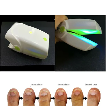 

Rechargeable Nail Fungus Laser Treatment Device Cure Onychomycosis Professional Toe Finger Nail Fungus Treatment Machine