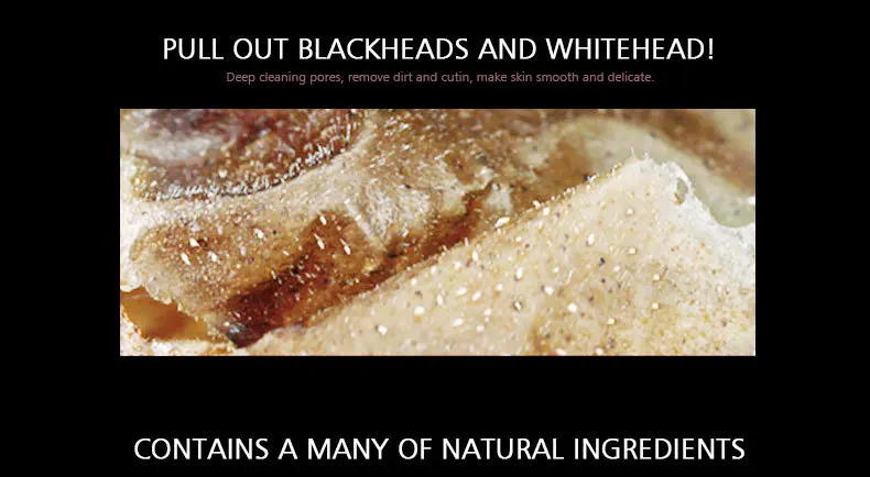 rose-blackhead-removal_05