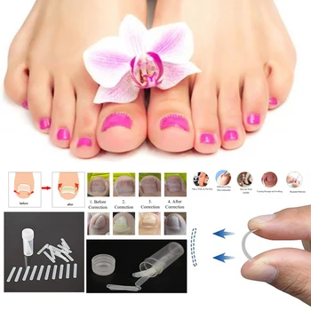 

10/50pcs Ingrown Toenail Correction Toe Nail Treatment Elastic Patch Sticker Straightening Clip Brace Pedicure Foot Tool New