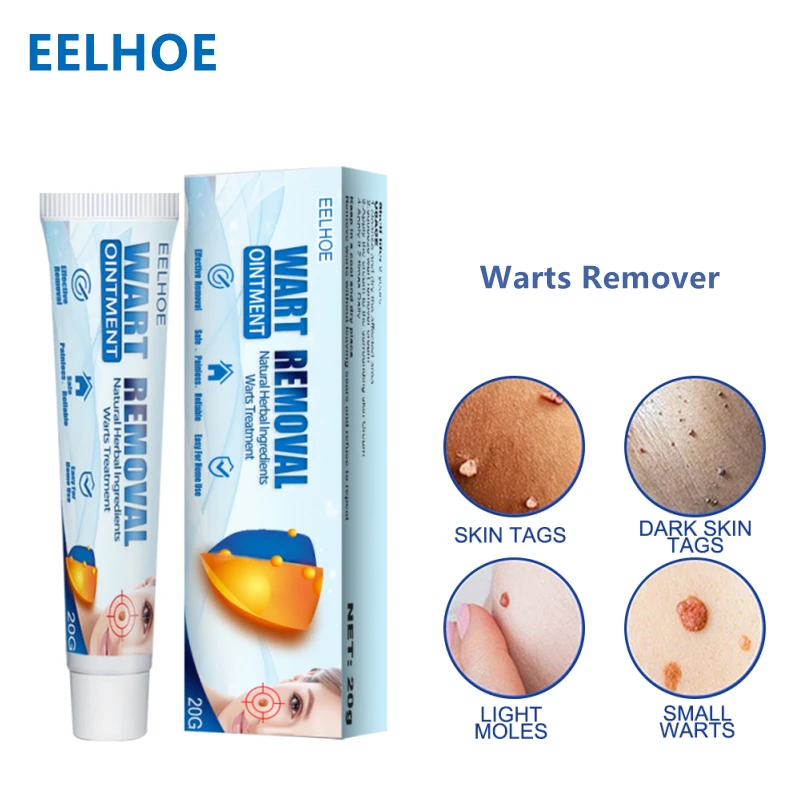 EELHOE 20g Warts Remover Ointment Acne Wart Treatments Cream Skin Tag