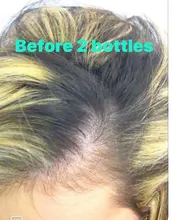 Crecimiento del cabello Aceites esenciales Esencia Anti Pérdida del cabello Productos Cuidado de la salud Belleza Crecimiento más rápido Crecimiento denso Cuidado del cabello Suero líquido