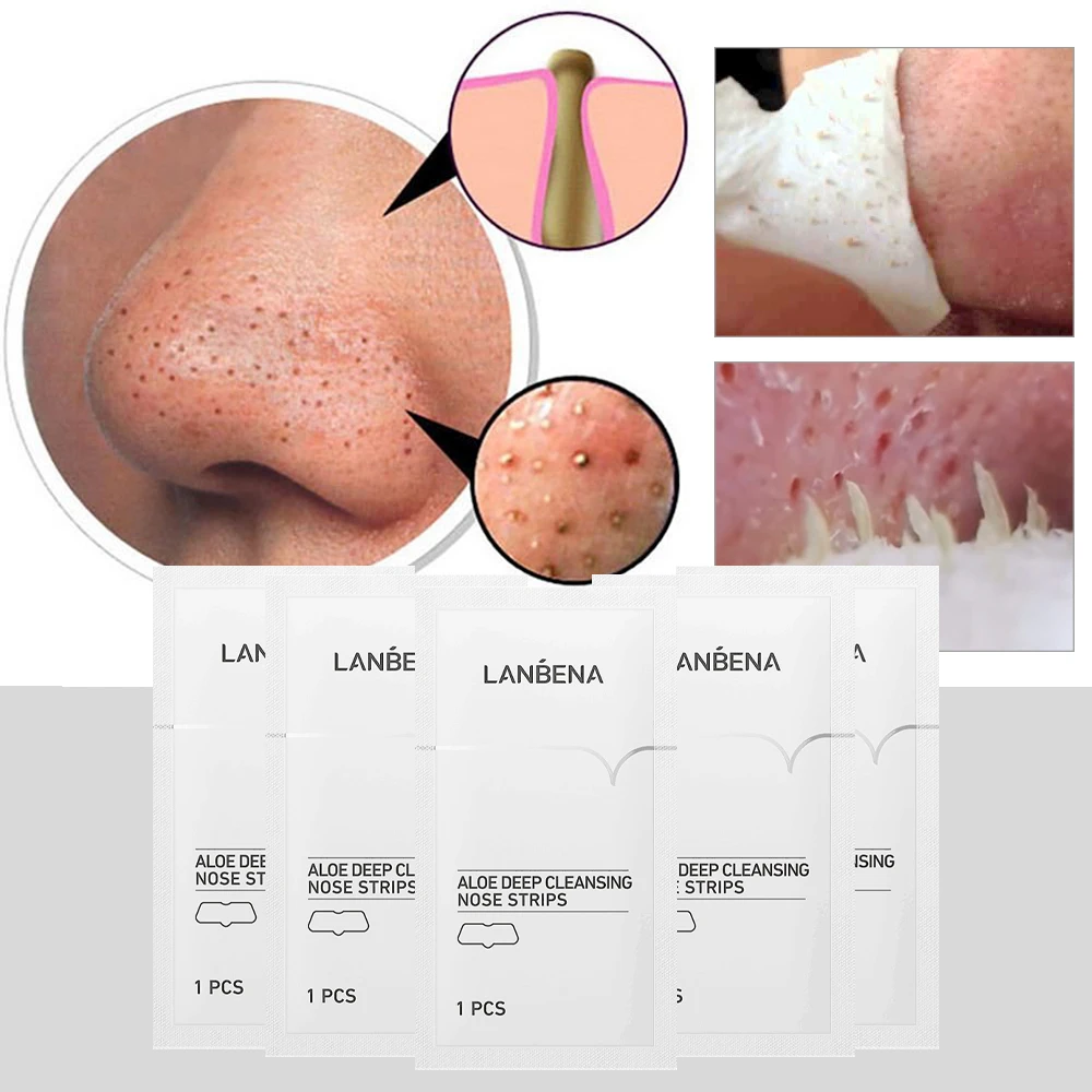 Como Quitar Espinillas Negras De La Nariz Parche eliminador de espinillas nasales, limpieza profunda de puntos  negros, acné, hidratante, Control de aceite, reduce los poros de la nariz,  tiras de limpieza de puntos negros, 5 piezas|Tratamientos y mascarillas| -