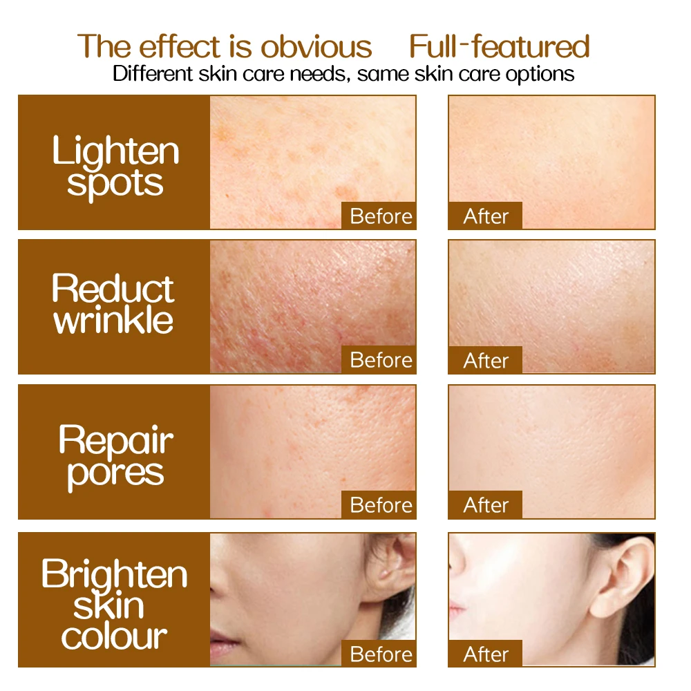 Рисунок 3 - Роликовая микро-игла Derma ZGTS 192 титановые 0