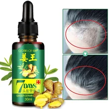 Suero Germinal de jengibre para la pérdida de cabello, aceite Sérum para tratamiento del crecimiento del cabello, prevención de la pérdida de cabello, líquido dañado, reparación del cabello, 7 días