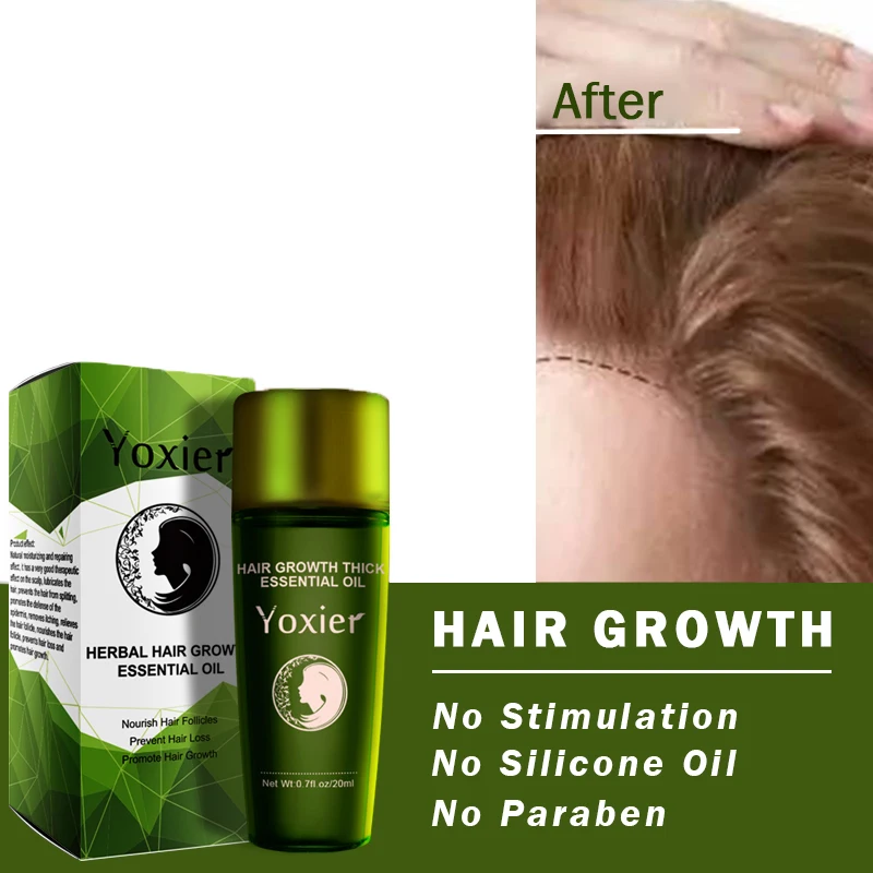 Yoxier Herbal Hair Growth Essential Oil Shampoo hair care styling Hair Loss Product Thick Fast