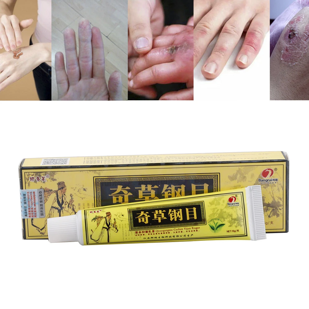 15g Psoriasis Cream For Dermatitis And Eczema Pruritus Ointment Herbal Creams J75 |