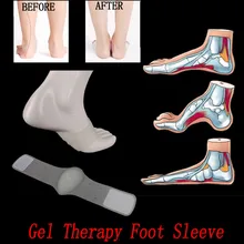 1 пара подушечек для ног, плоская подошва, Подошвенный Фасцит, подушка и поддержка с гелевой терапией, рукав для ног, Прямая