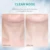 ANLAN Neck Face Beauty Device 3 Colors LED Photon Therapy Skin Tighten Reduce Double Chin Anti Wrinkle Remove Skin Care Tools