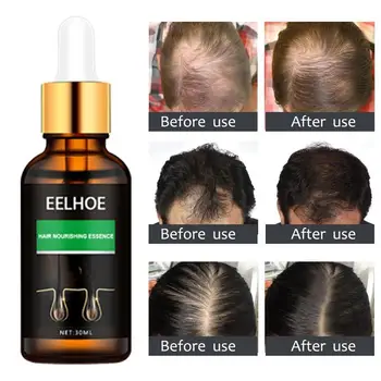 

30ml Hair Growth Essential Oil Nourishing Hair Treatment Hair Essential Essential Hair Repair Oil Follicles Damaged Oil T6X7