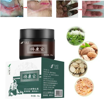 

ZB 50g Removal rot myogenic cream chinese herbal cream bedsores paste treat pressure sores decubituses pressure ulcer festering