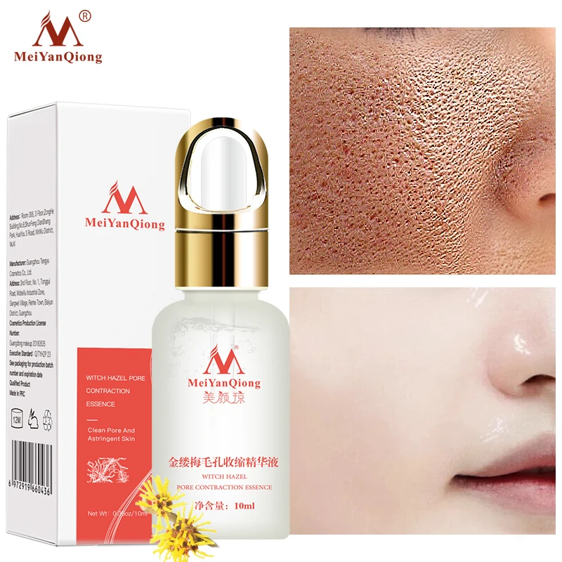 does witch hazel brighten skin