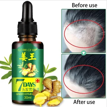 

Hair Growth Essential Repair Growing Faster Anti preventing Hair Loss alopecia Liquid Damaged Health Care Beauty Dense Care