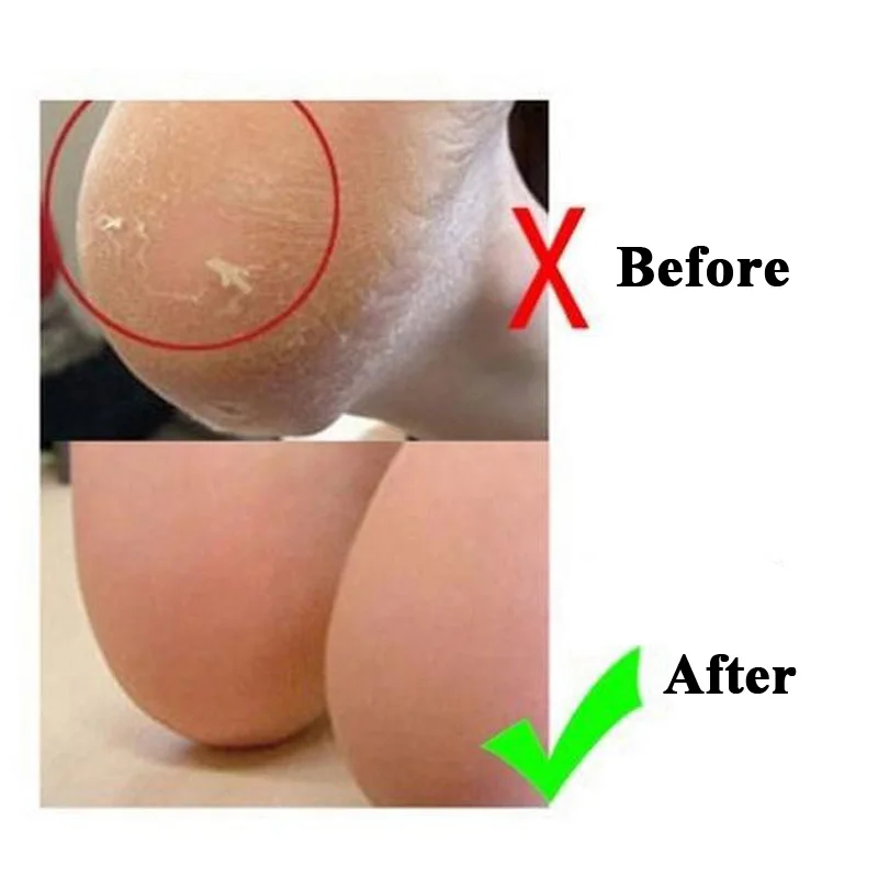 Мягкий Силиконовый протектор для стопы пятки носки предотвращают сухость кожи против трещин пилинг моющийся Увлажняющий Гель Защита ноги