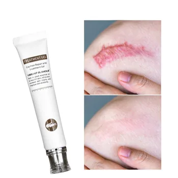 

Repairing scars Acne scars removal cream Stretch marks gel Operation Scars from burns for body pigmentation Repair Facial care