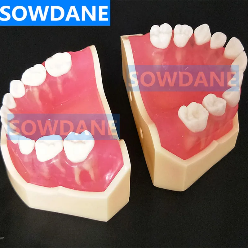 Стоматологическая 1:1 Учебная модель Стоматологическая детская стандартная модель съемные зубы мягкие десны ребенок TYPODONT модель