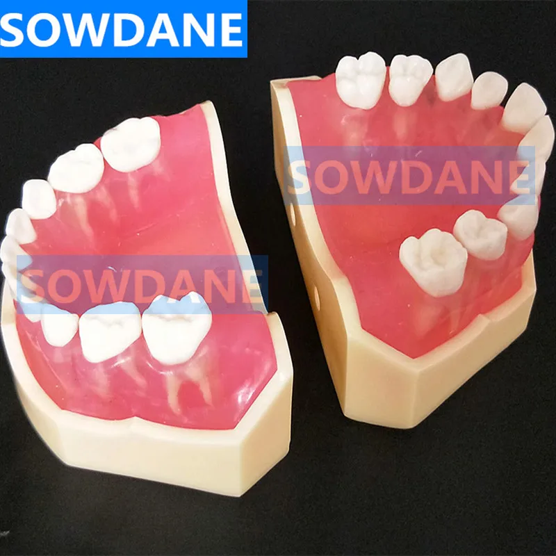  Dental 1:1 Study Teaching Model Dental Children Standard Model Removable Teeth Soft Gum Kid TYPODON - 4000170129781