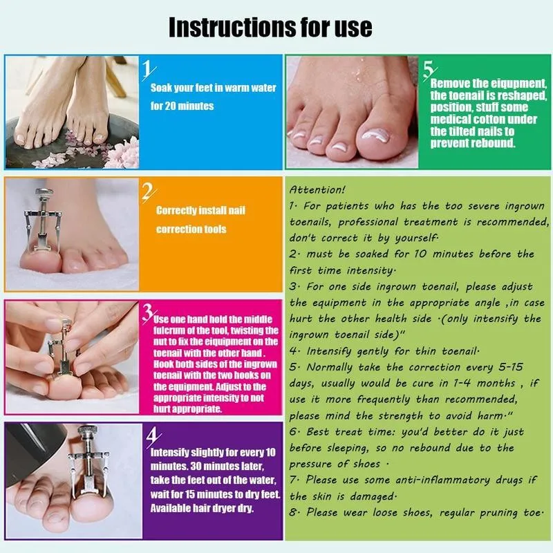Stainless Steel Nail Art Correction Tool Of Foot Toe Nails Meat Claws Ingrown Orthosis Pedicure Tools Feet Corrector Health Care