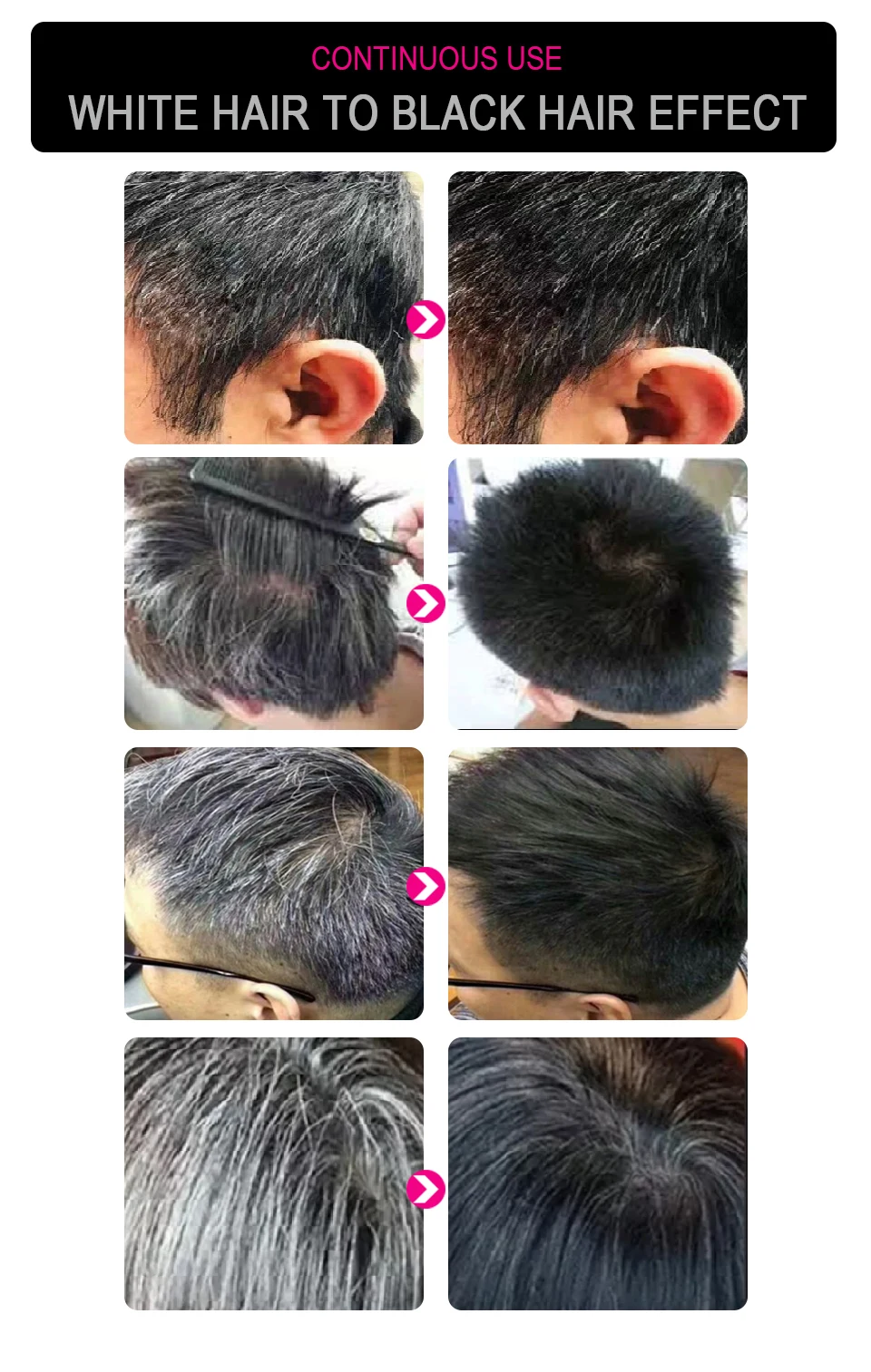 Sevich Hair Growth Spray Grey Hair Treatment Restoration Black Hair Anti Hair Loss White Hair Repair Serum Hair Loss Product Sevich Hair Growth Spray Grey Hair Treatment Restoration Black Hair Anti Hair Loss White Hair Repair Serum Hair Loss Product