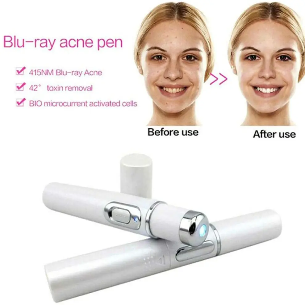 Blue Light Therapy Varicose Veins Treatment Laser Pen Soft Scar Wrinkle Removal Treatment Acne Laser Pen Massage Relax blue light therapy pen laser pen therapy