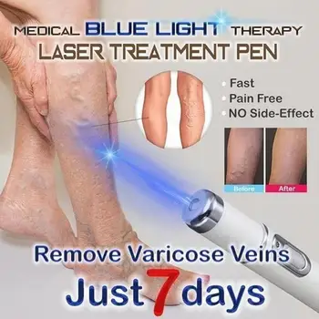 

7 Days Varicose Veins Treatment Medical Blue Light Scar Pen Wrinkle Hot Just Removal Scars Acne Therapy Laser Treatment Sof H6Q4