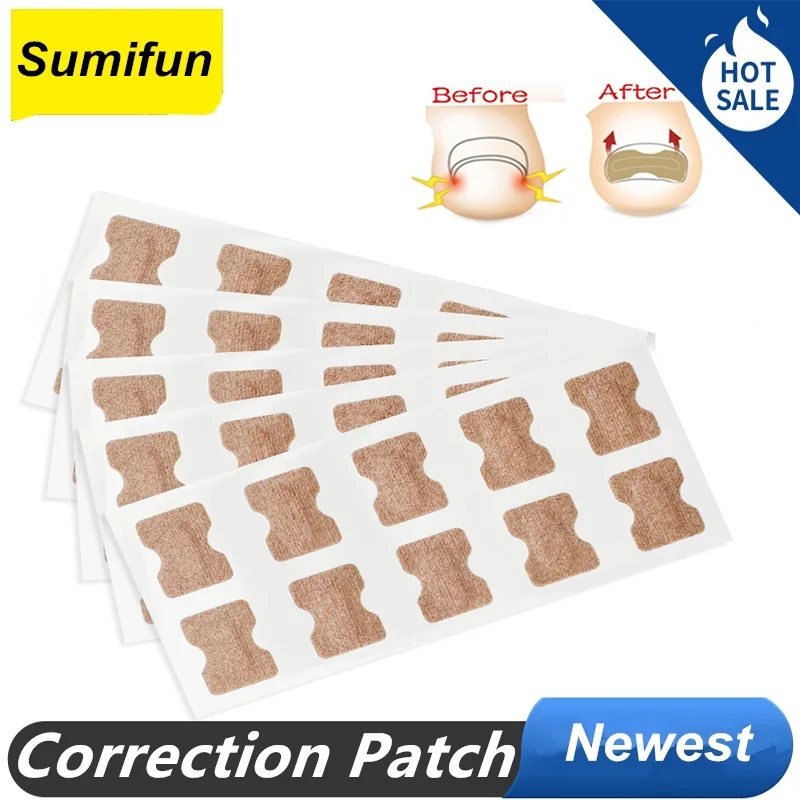 

10 Pcs To 60 Pcs Toenail Patch Ingrown Free Toenail Patch Correction Toe Corrector Nail Patch Sticker Nail Treatments