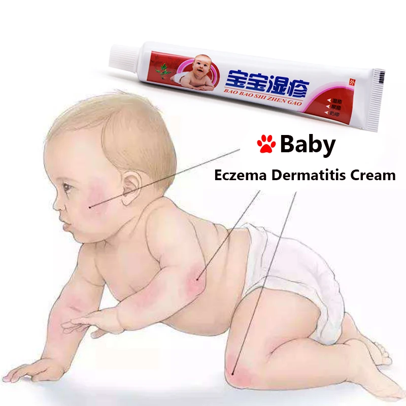 1pcs Baby Eczema Cream Psoriasis Pruritus Dermatitis Itching Repair Skin Chinese Herbal Medical Plaster Ointment S011