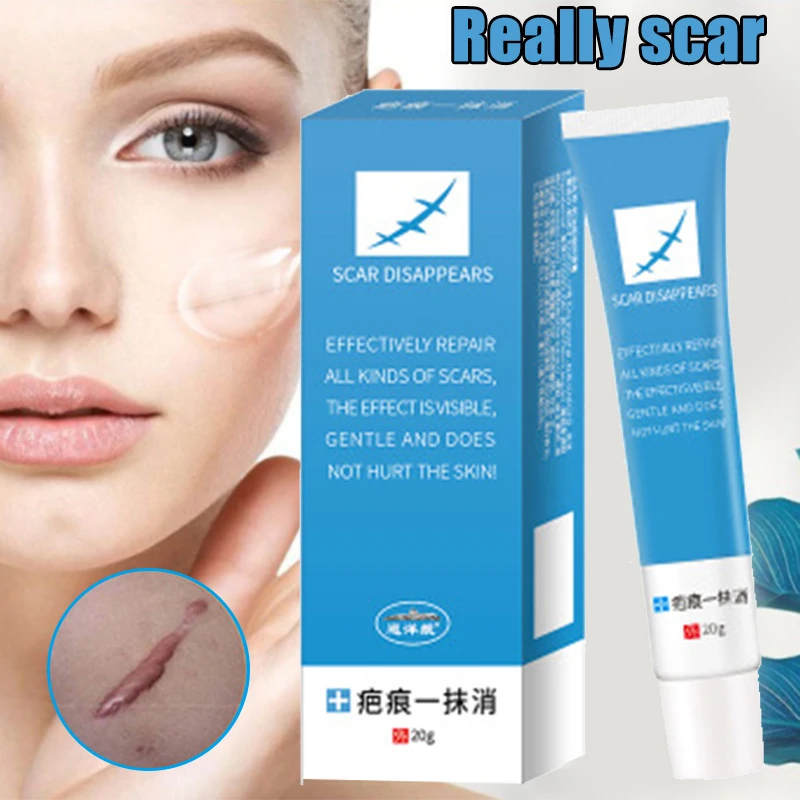face shadow removal cream