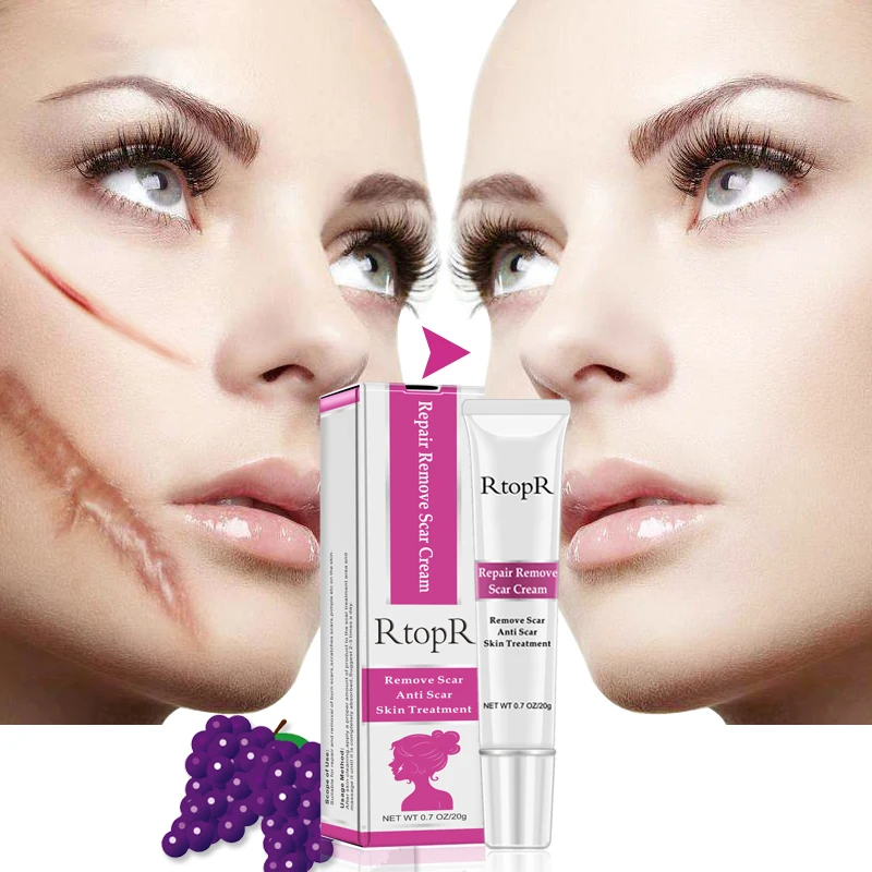 

RtopR Acne Scar Stretch Marks Remover Cream Skin Care Repair Face Cream Acne Spots Acne Treatment Blackhead Whitening Cream