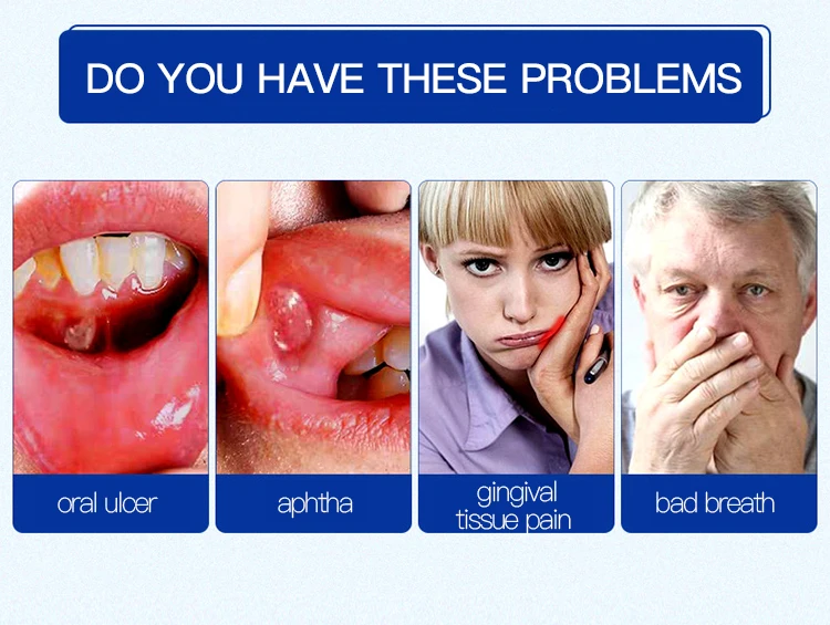 Облегчение язвы рта гель натуральный травяной оральный Антибактериальный крем быстрое облегчение от сильной боли и раздражения в течение 2 минут