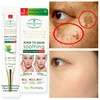 Whitening Freckle Cream Remove Dark Spots Melasma Acne Spot Pigment Wrinkles Gel Moisturizing Smooth Repair Sunburn Skin Care