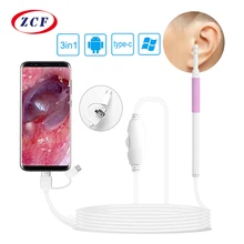 AN102 3 в 1 ушной очиститель отоскоп 2 м кабель визуальный ушной pick er 5,5 мм эндоскоп камера 480p визуальный отоскоп медицинский ушной pick