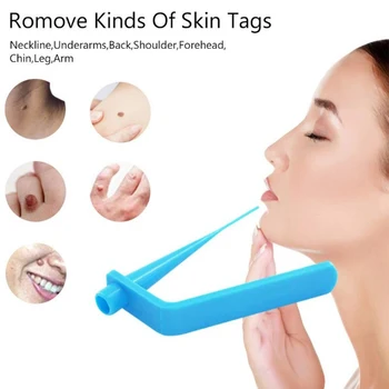 

Skin Tag Remover Wart Remove Acne Pimple Blemish Treatments Face Skin Care Beauty Tools Micro Tag Removal