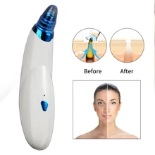 Удаление прыщей вакуумный очиститель пор Removedor de cravo elétrico poros aspirador de pó preto cabeça removedor máquina limpeza profunda rosto cravos sucção mais limpo чистка пор для выдавливания угрей