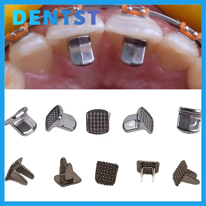 10pcs Dental Orthodontic Monoblock Bite Turbos Bite Opener Metal Bite