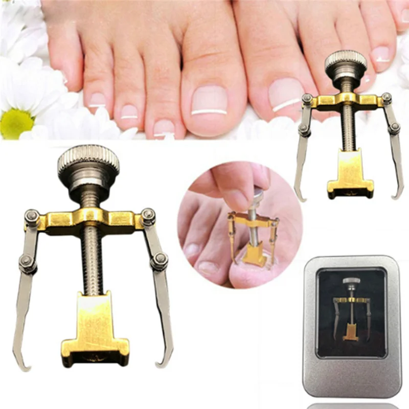 Ingrown Toe Nail Recover Correction Pedicure Toenail Fixer Orthotic Nail Corrector Foot Care Tool Ingrown Toe Nail Recover Correction Pedicure Toenail Fixer Orthotic Nail Corrector Foot Care Tool