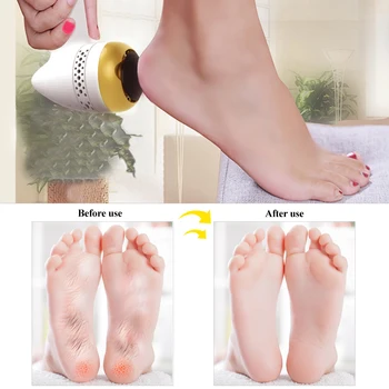

Electronic Foot File Rechargeable Vacuum Adsorption Pedicure Machine Multifunction Electric Remove Calluses Foot Care Tool