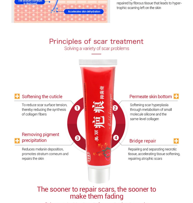 acne scar removal cream