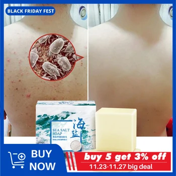 

100g Removal Pimple Pore Acne Treatment Sea Salt Soap Cleaner Moisturizing Goat Milk Soap Face Care Wash Basis Soap TSLM1