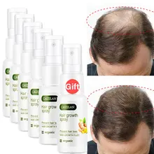 

Buy 5 Get 1 Free Hair Growth Spray Serum Ginger Extract Growing Serum Prevent Hair Loss Care Scalp Treatment Thickener Essence