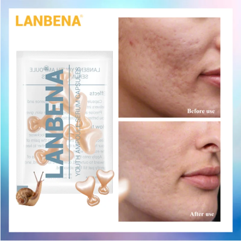 LANBENA гиалуроновая кислота, ампульная капсула улитки, увлажняющий крем для лица, отбеливающий, против старения, лечение акне, сыворотка для кожи, 5 Зерен