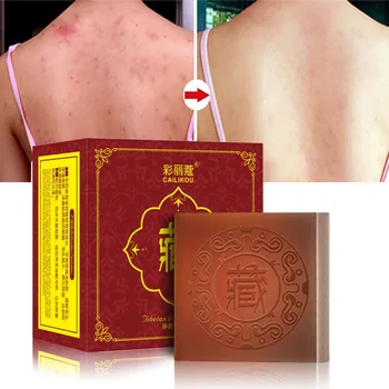 

Tibetan Handmade Soap Moisturizing Oil-control Anti Mites Anti Acne Cleansing Soap Efficient Face Care