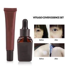 Professional Plant Essence Vitiligo Cover Liquid Waterproof Long-Lasting Set Scar Tattoo Concealer Hiding White Spots Birthmarks