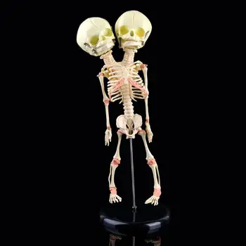 

Human Double Head Baby Skull Research Model Skeleton Anatomical Brain Anatomy Teaching Study Display