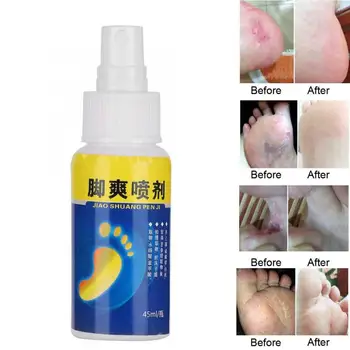 

45ml Odor Eliminates Deodorizer Anti Bacterial Anti-fungi Anti Itch Foot Spray Liquid Anti Itch Foot Spray Antiperspirants a