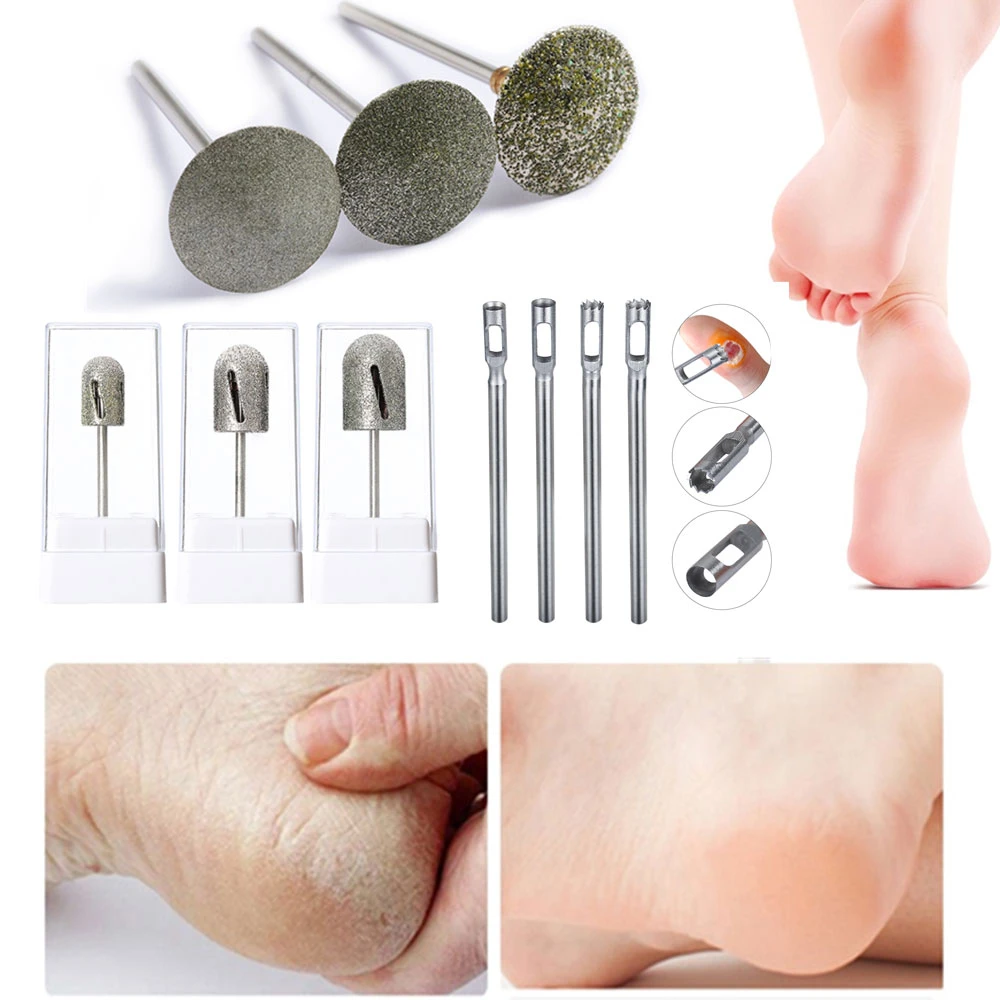 аппаратная алмазная насадка для пяток. фреза для смарт педикюра. насадки для маникюрного аппарата beurer mp60. 80 грит для педикюра. аппаратный педикюр пяток фрезами.